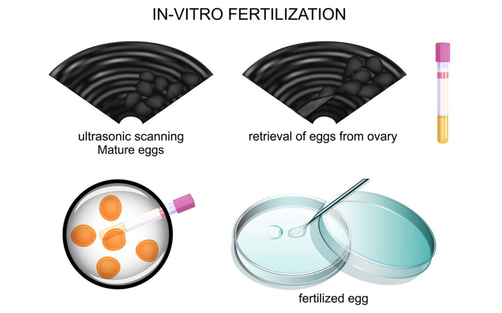 Best IVF Clinic in thane